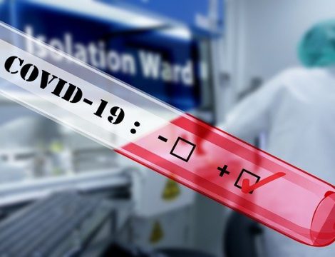 Coronavirus 2020 Positive Covid-19 test